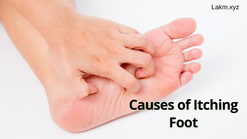 Causes of Itching Foot